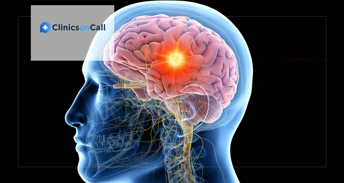 What are the symptoms & causes of craniopharyngioma ? - Clinics on Call