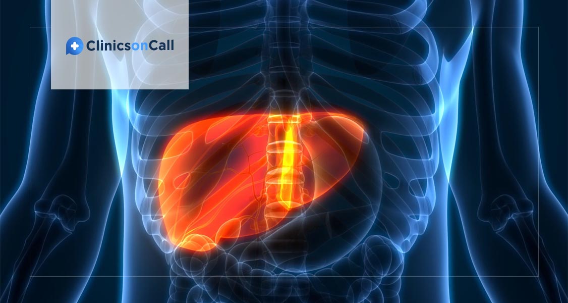 Diagnosis and Treatment of Liver Cancer in Foreign Clinics