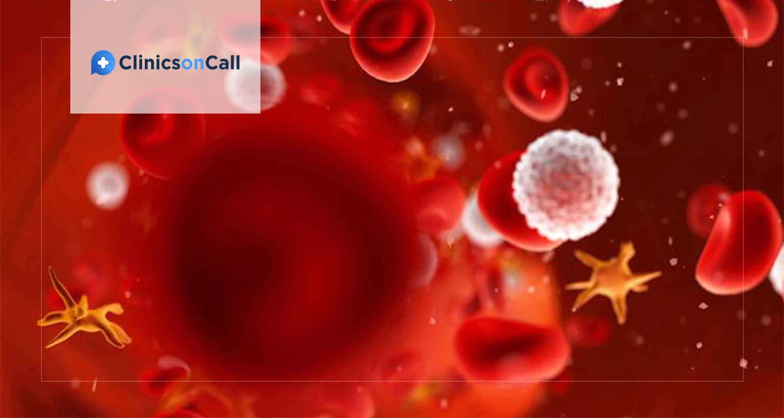 Blood Cancer Leukemia Treatment in Germany