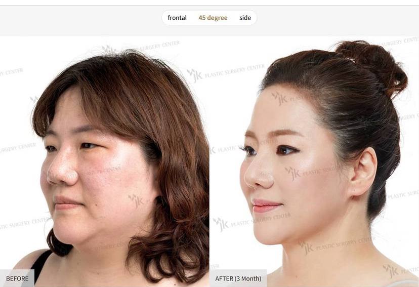 Slider 186787 - image