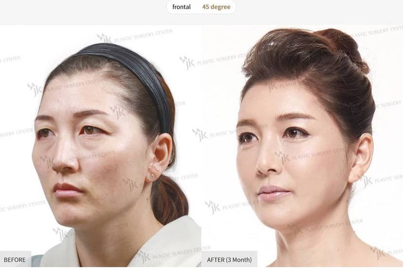 Slider 186787 - image