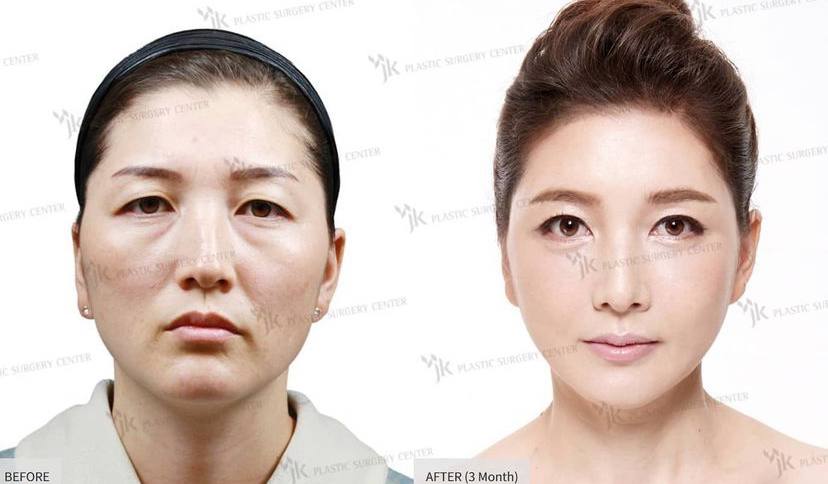 Slider 186787 - image