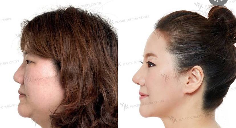 Slider 186787 - image