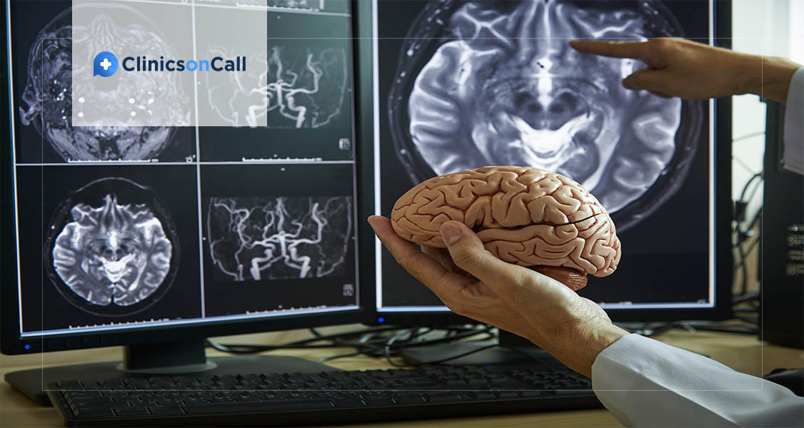 лечения анапластической менингиомы в Грузии