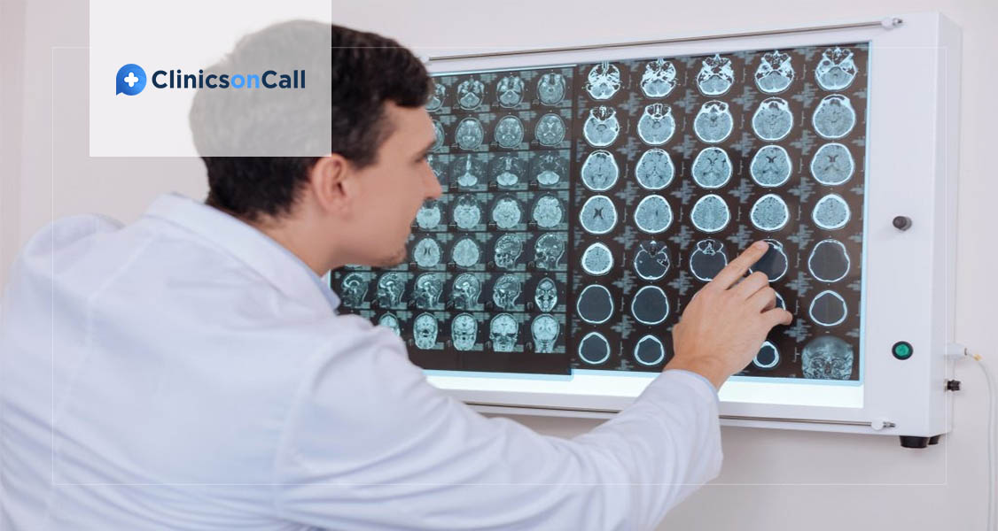 лечения анапластической менингиомы в Грузии