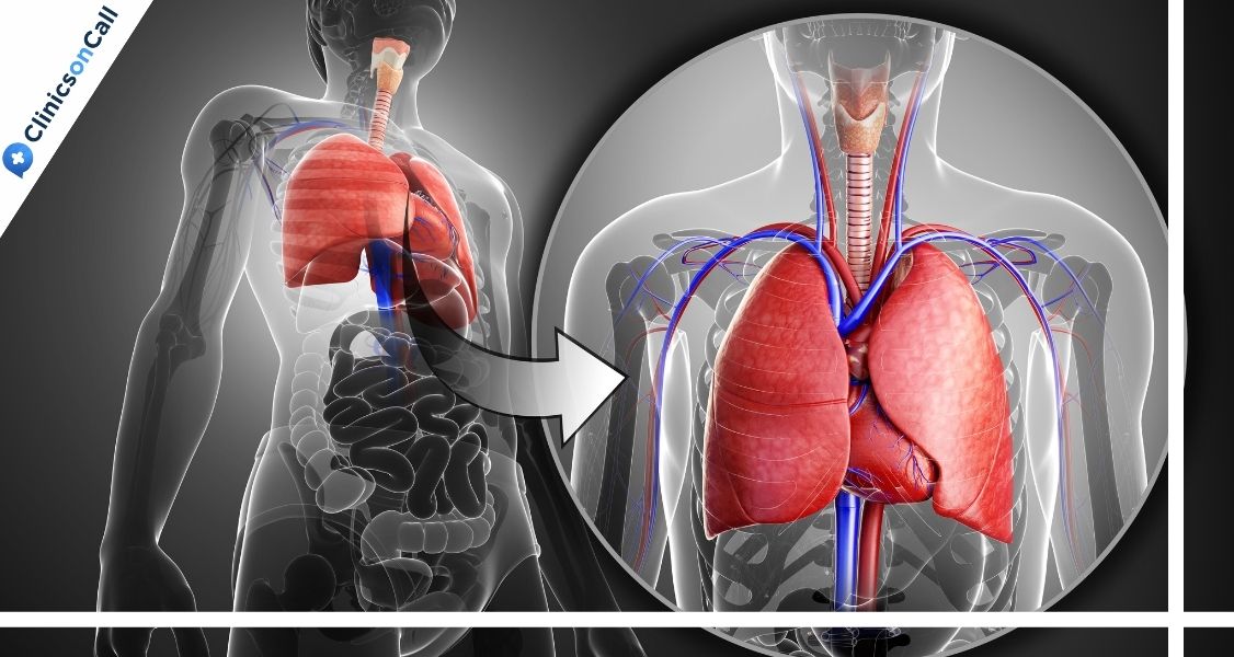 Лечение мезотелиомы в Грузии