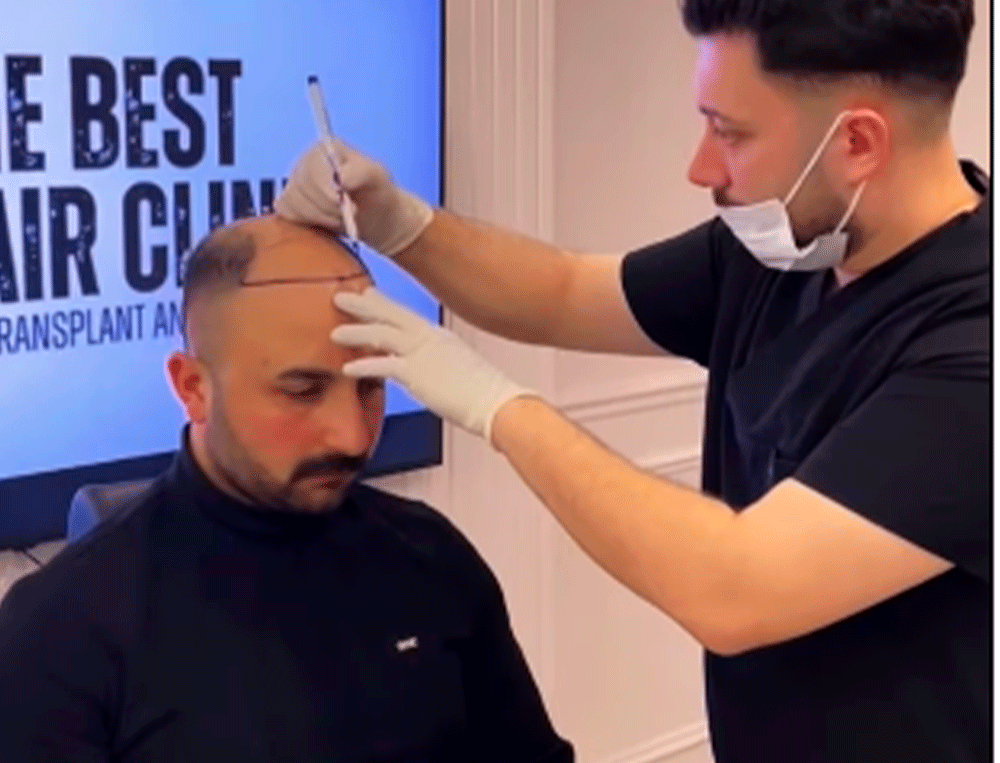 Клініка The Best Hair