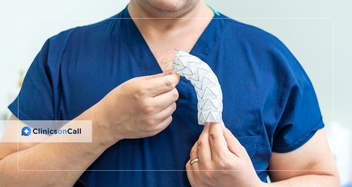 Аневризма грудной аорты симптомы, диагностика и лечение