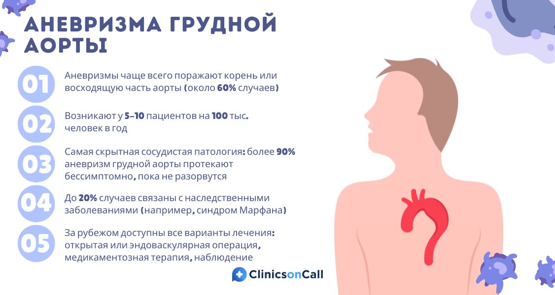 Аневризма грудной аорты симптомы, диагностика и лечение