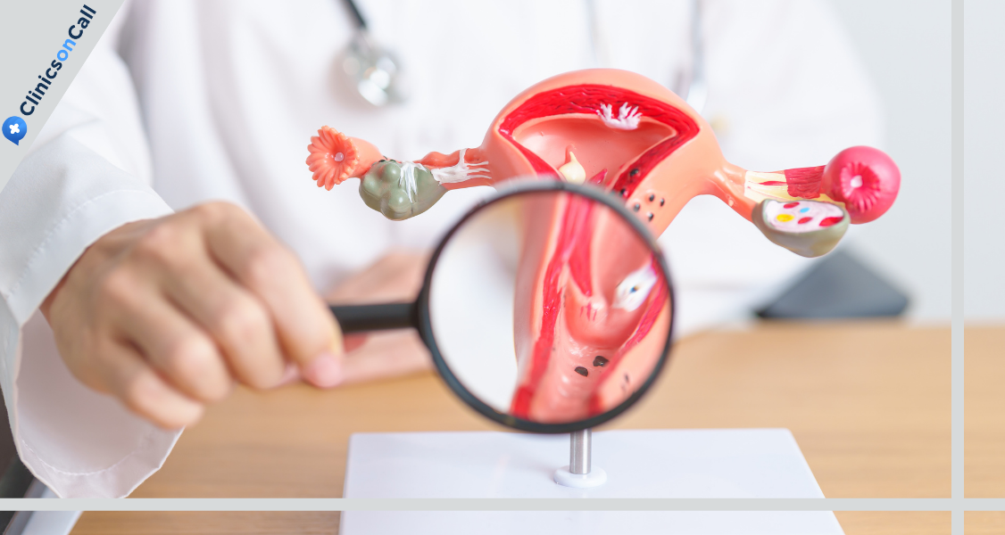 Предраковые болезни шейки матки