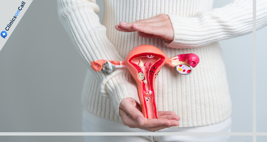 Предраковые болезни шейки матки